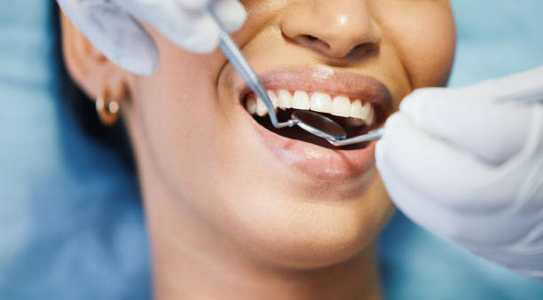 Best Emergency Root Canal Treatment in Ampere North, NJ