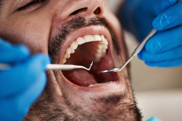 Best Emergency Treatment for Toothache in Ampere North, NJ
